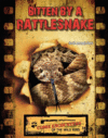 BITTEN BY A RATTLESNAKE